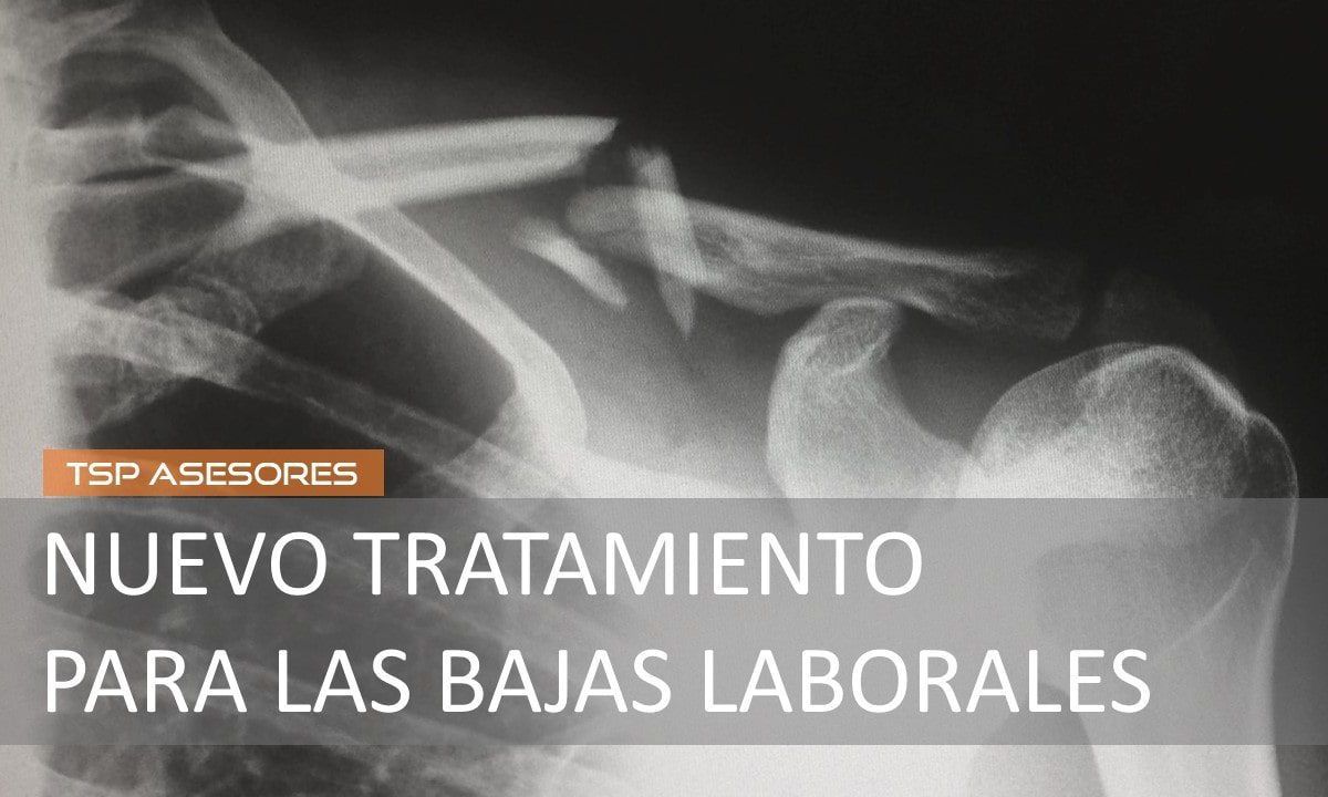Nuevo tratamiento para las bajas laborales